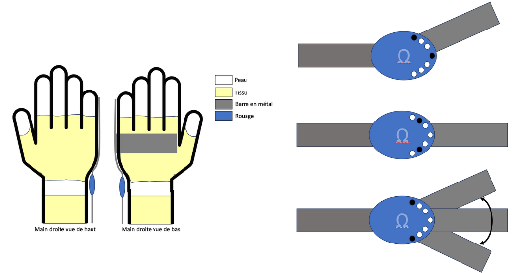 Figure 6 : Schéma de l’attelle articulée à élaborer et de son système de rouage.